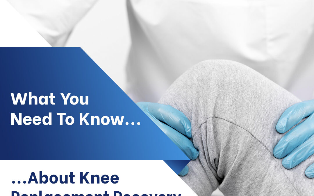 What You Need to Know About Knee Replacement Recovery
