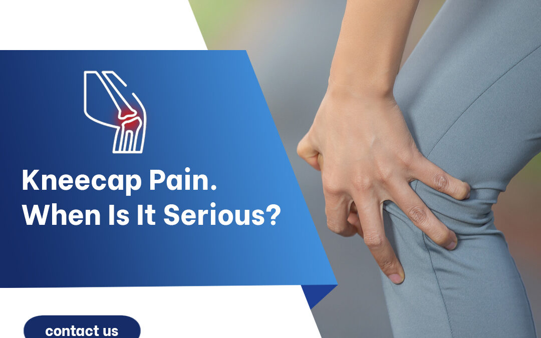 Kneecap Pain — When Is It Serious? Understanding Common Causes of Kneecap Pain and When to Seek Professional Care