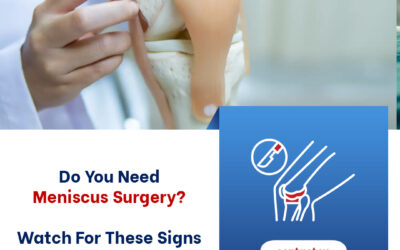 Do You Need Meniscus Surgery? Watch for These Signs