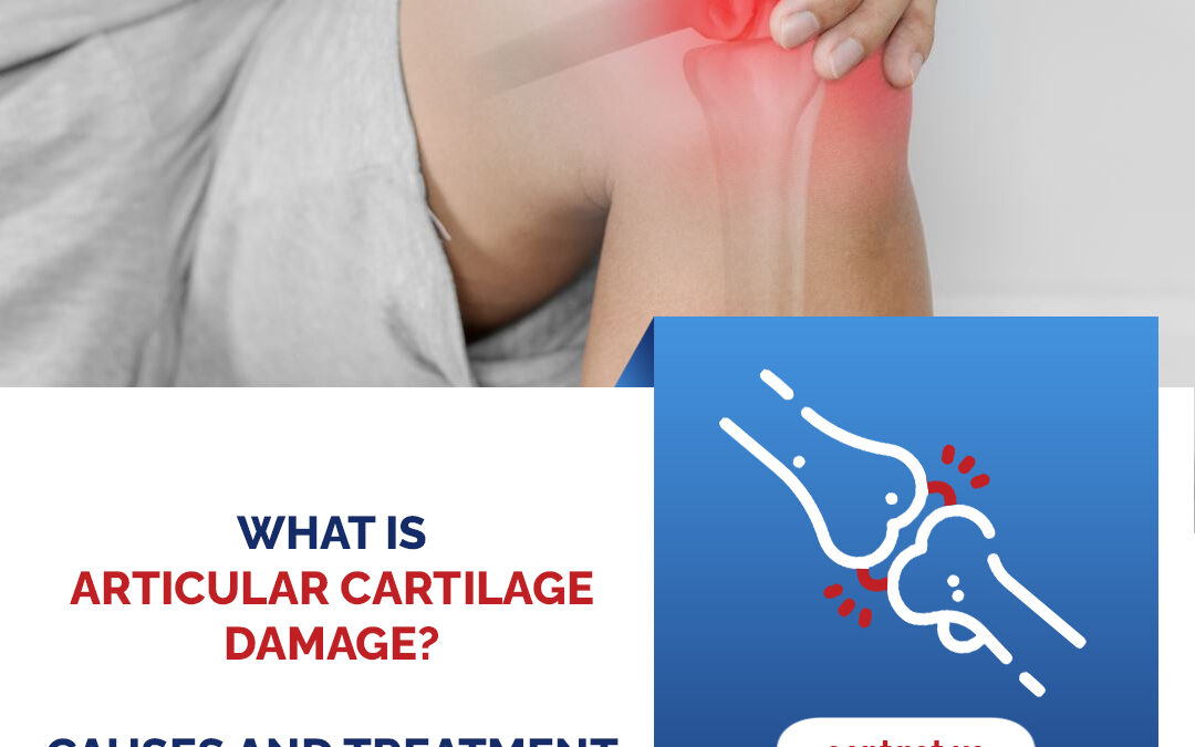 What is Articular Cartilage Damage? Causes and Treatment