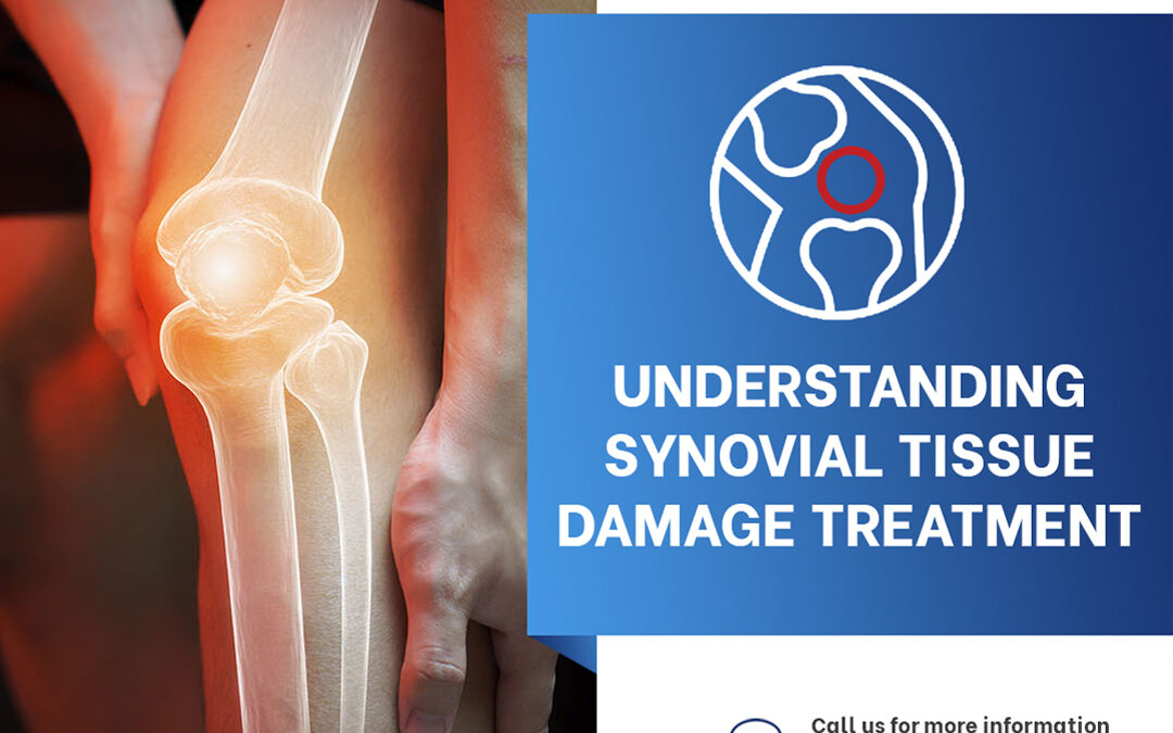 Understanding Synovial Tissue Damage Treatment